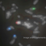 Déconvolution de chromosomes en metaphase, en imagerie de fluorescecne (champ large)